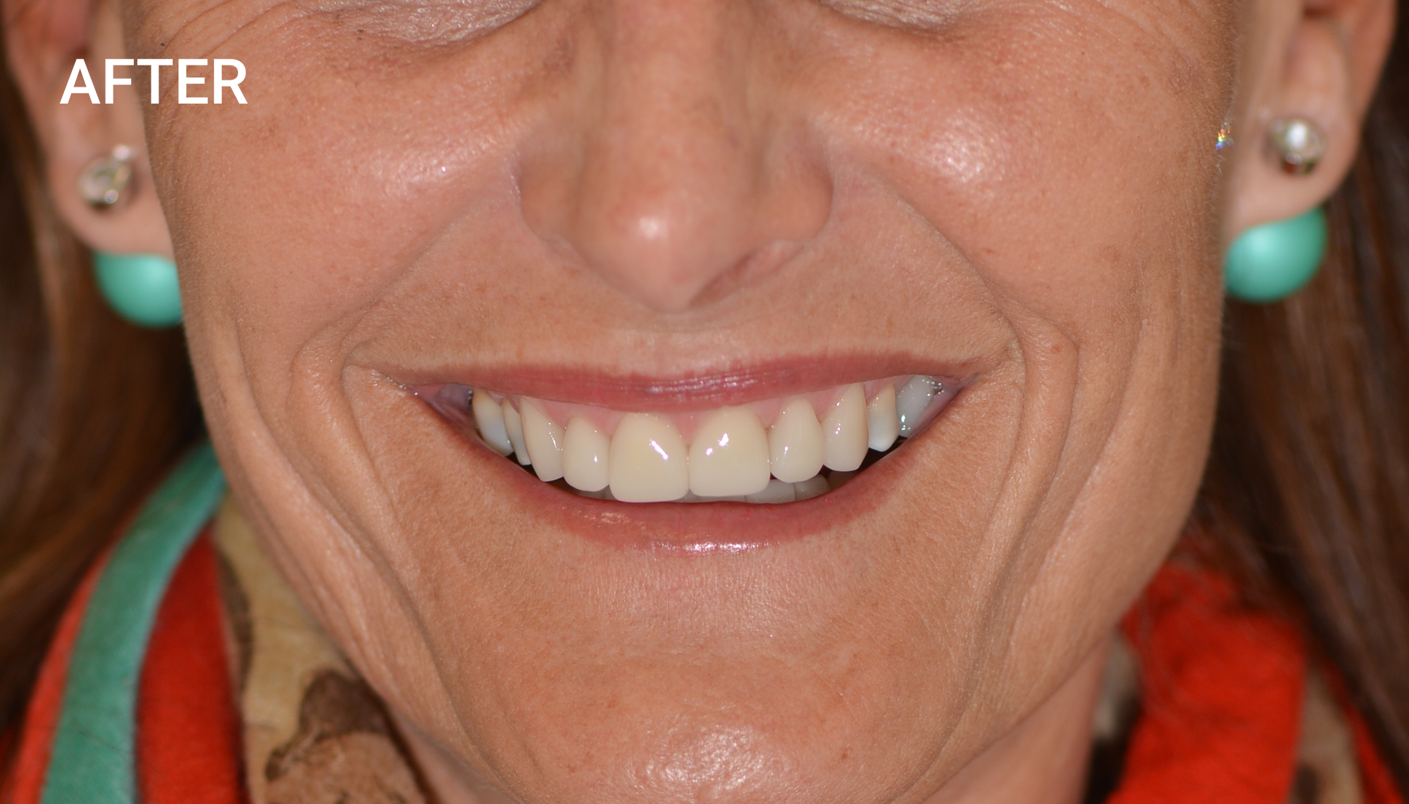 WORK COMPLETED BY DR. MICHAEL HARRIS (Dentist)